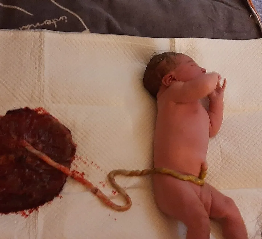 Recién nacido junto a su placenta